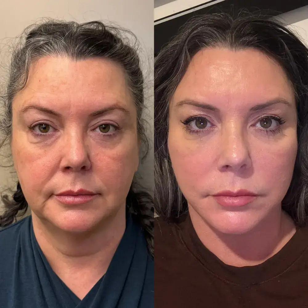 Oak & Aura pro Sculpt 2.0 Oak & Aura 0 Oak & Aura